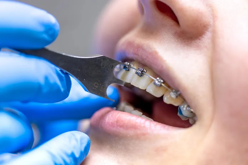 SEO for Orthodontists
