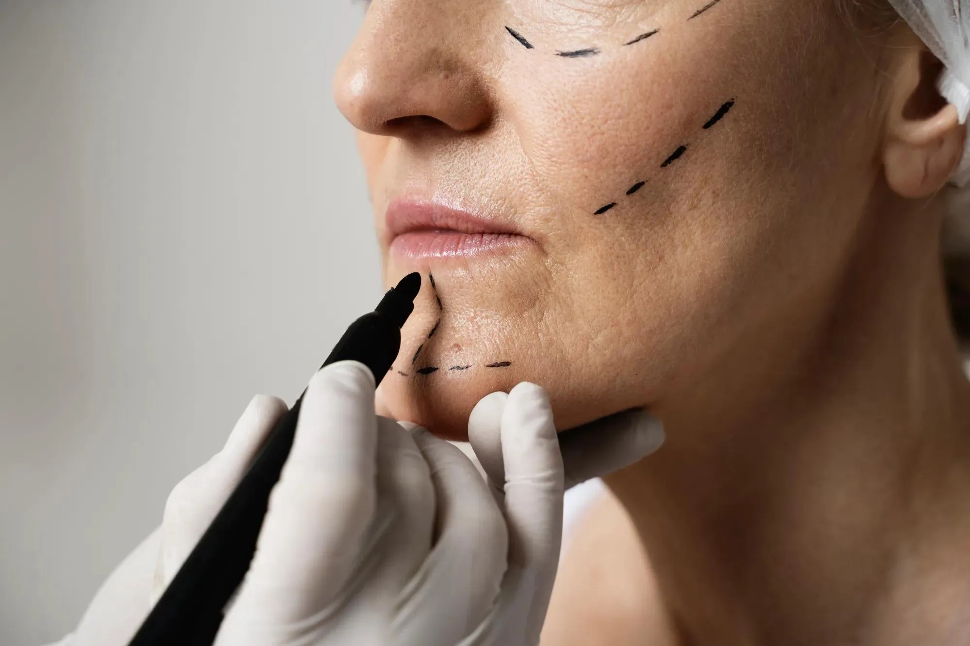 SEO for Plastic Surgeons
