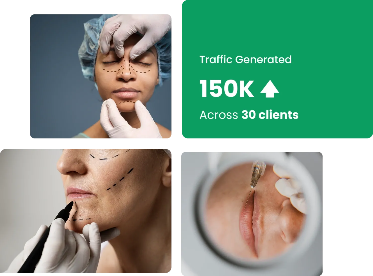 SEO for Plastic Surgeons